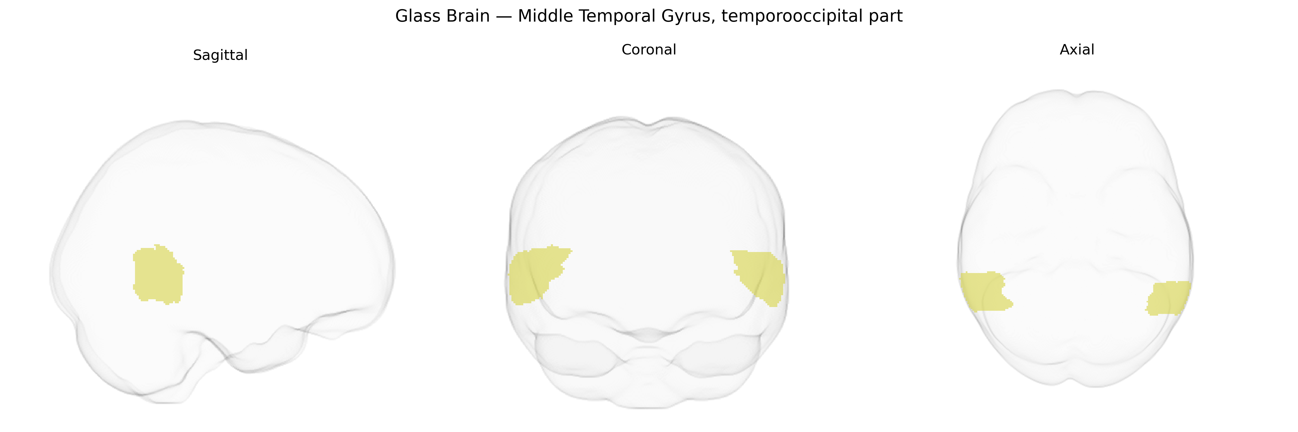 Triplanar Ghost Brain