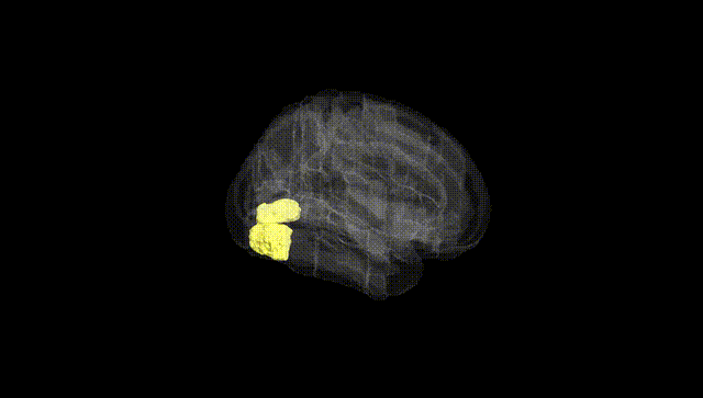 Full Brain Black