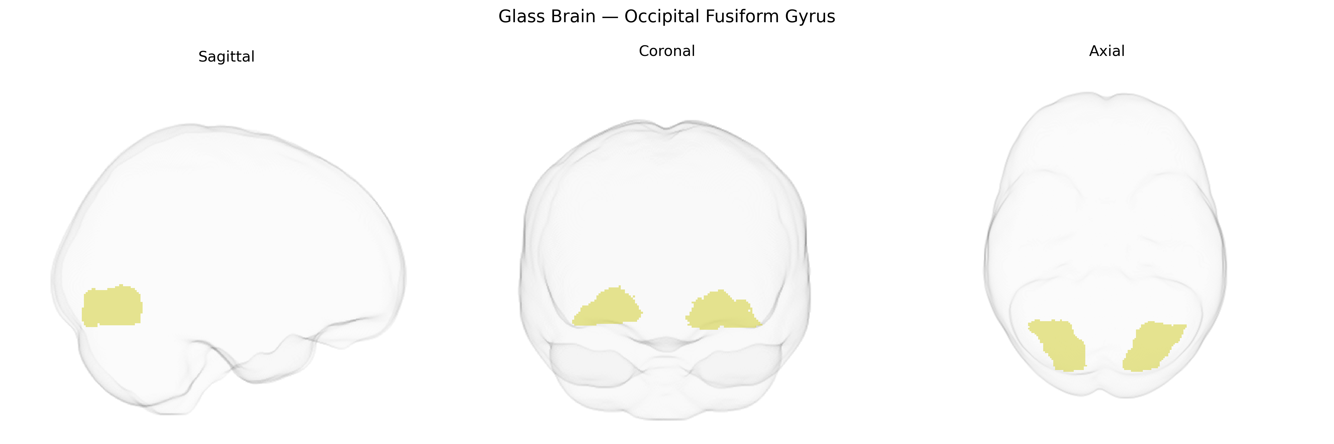 Triplanar Ghost Brain