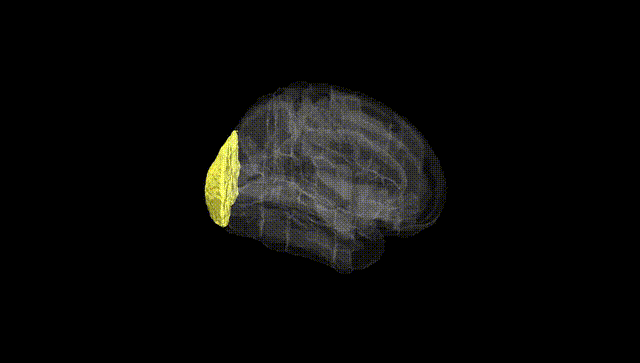 Full Brain Black