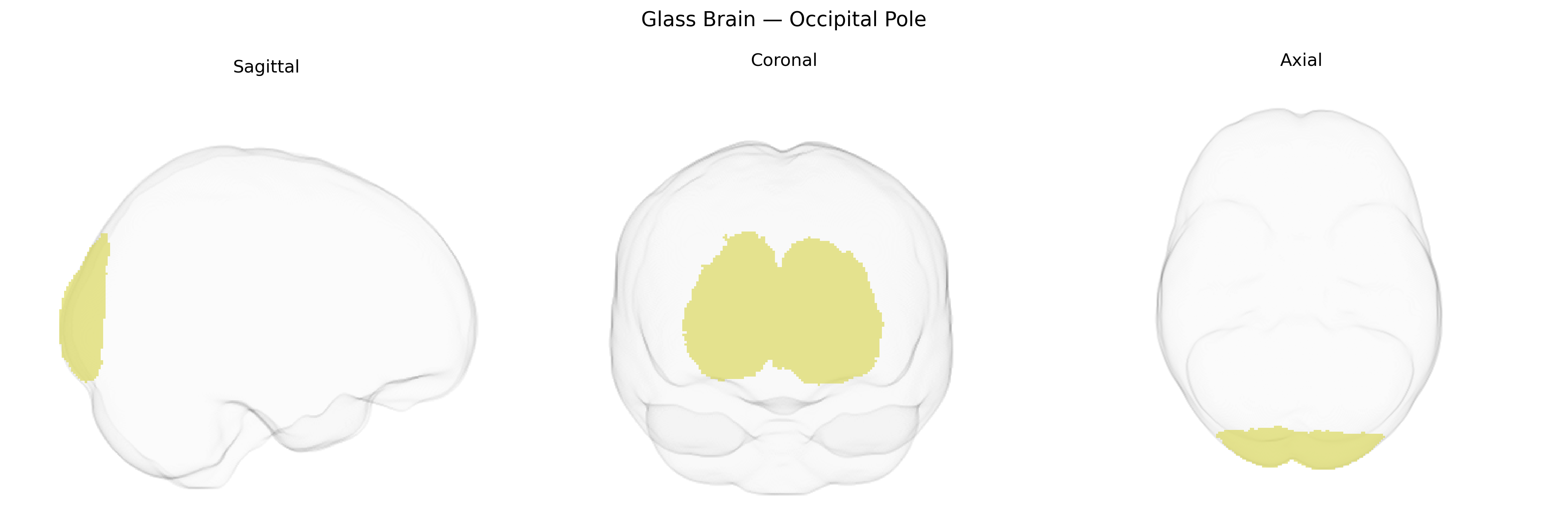 Triplanar Ghost Brain