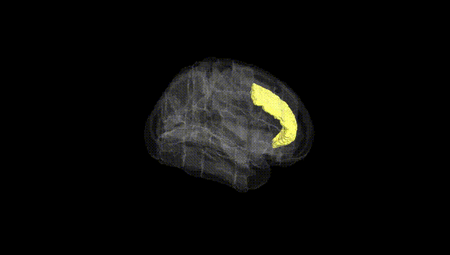 Full Brain Black