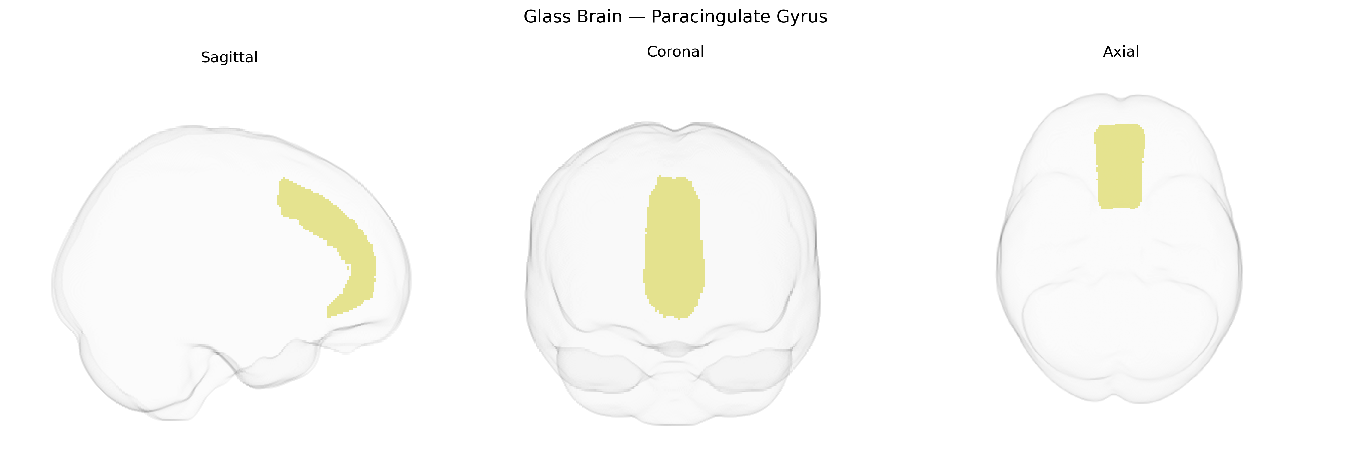 Triplanar Ghost Brain