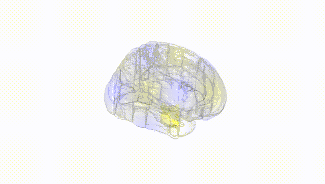 Full Brain White
