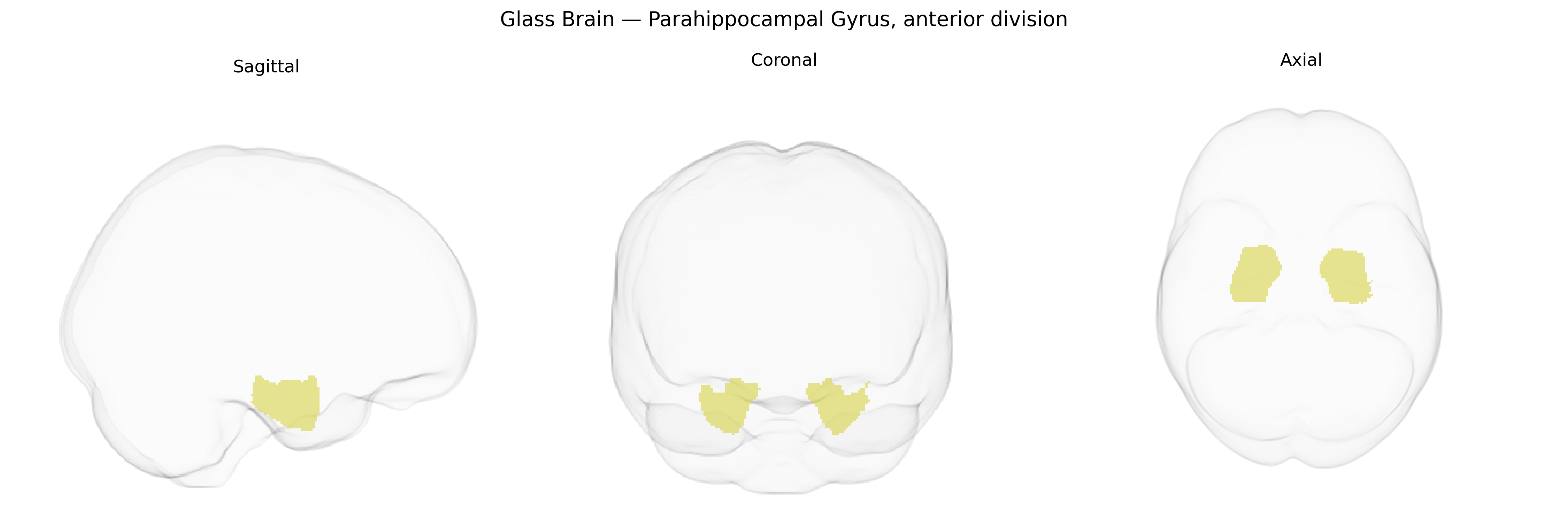 Triplanar Ghost Brain