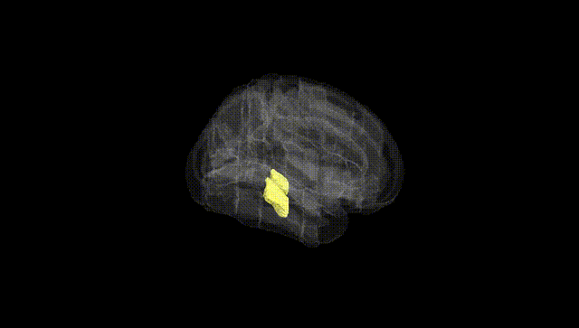 Full Brain Black