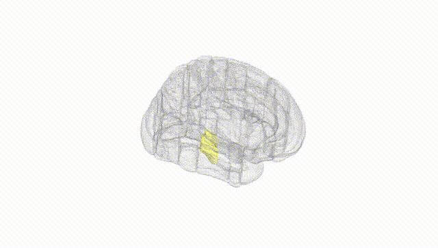 Full Brain White