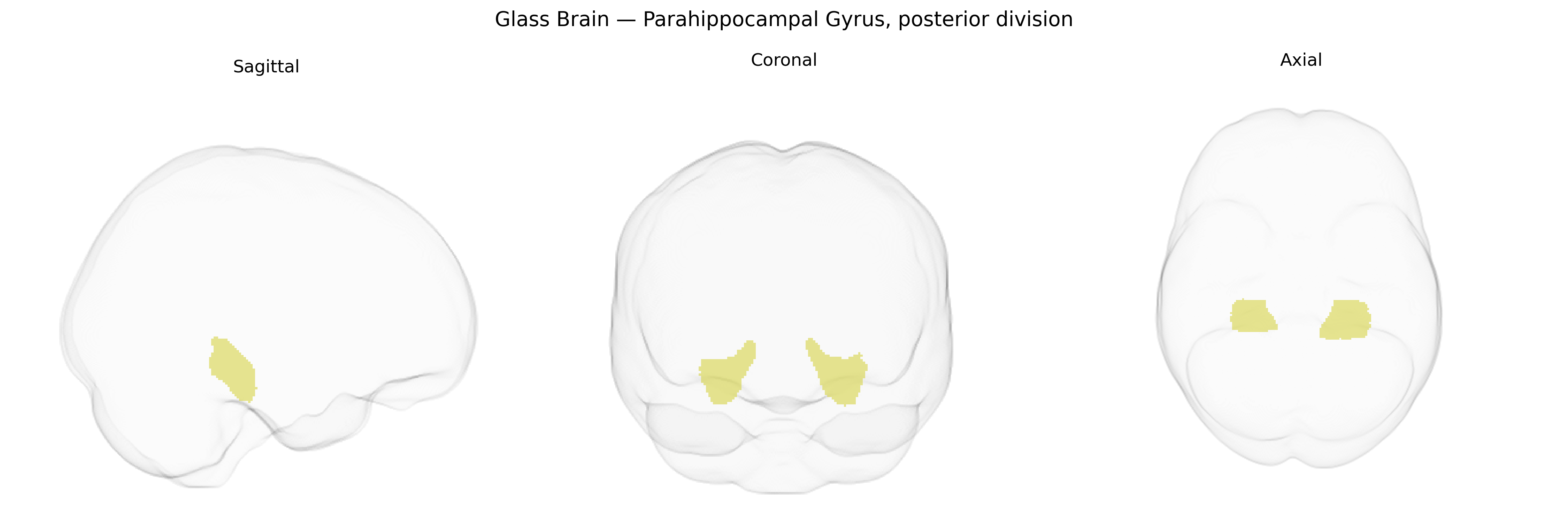 Triplanar Ghost Brain