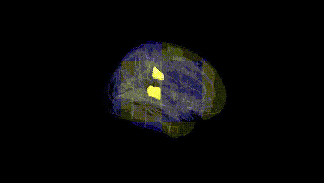 Full Brain Black
