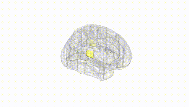 Full Brain White