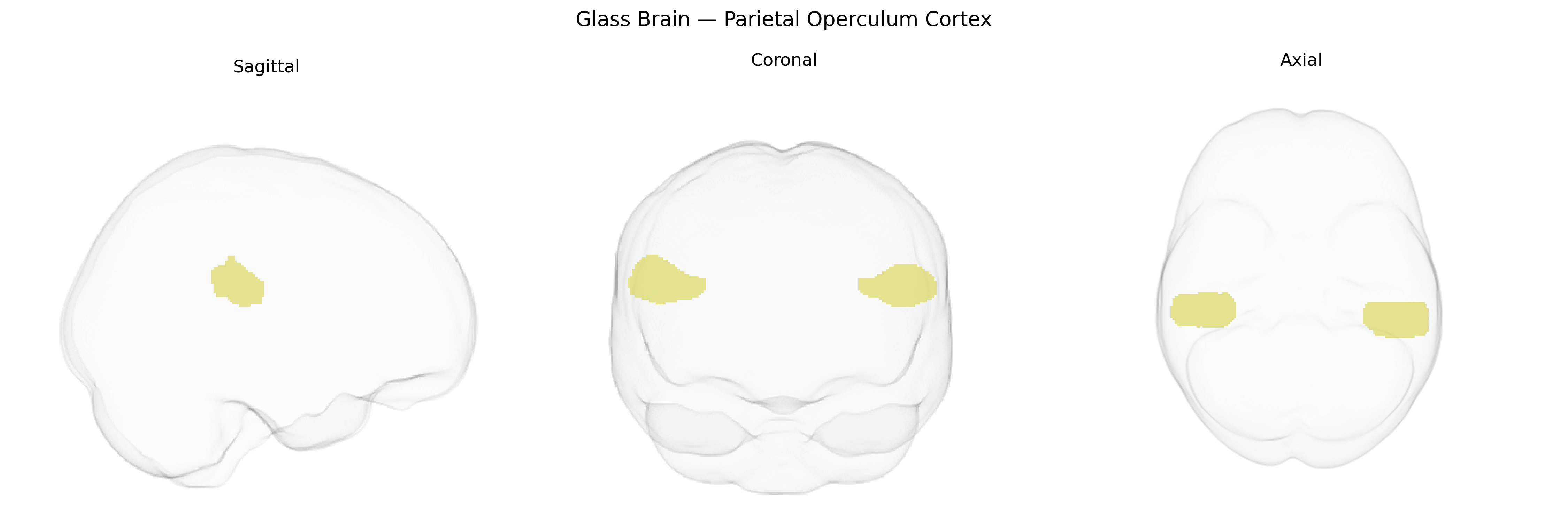 Triplanar Ghost Brain