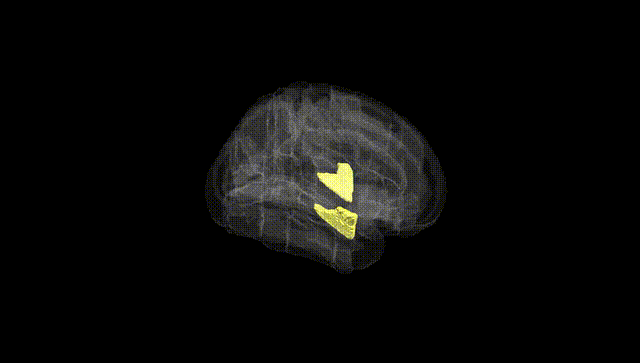Full Brain Black