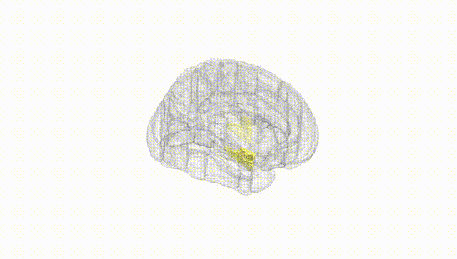 Full Brain White