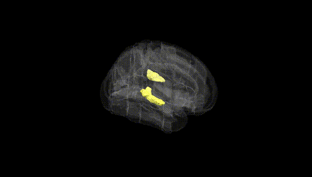 Full Brain Black