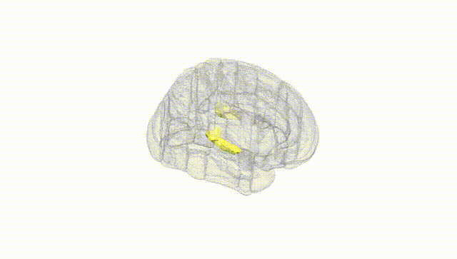 Full Brain White