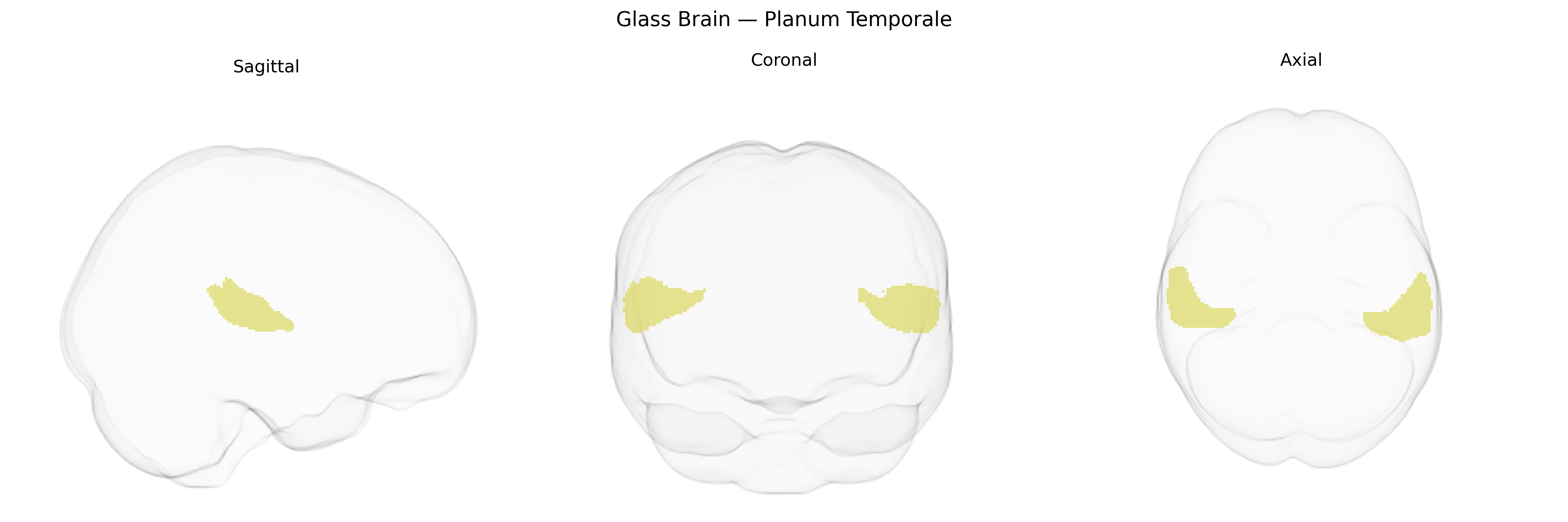 Triplanar Ghost Brain