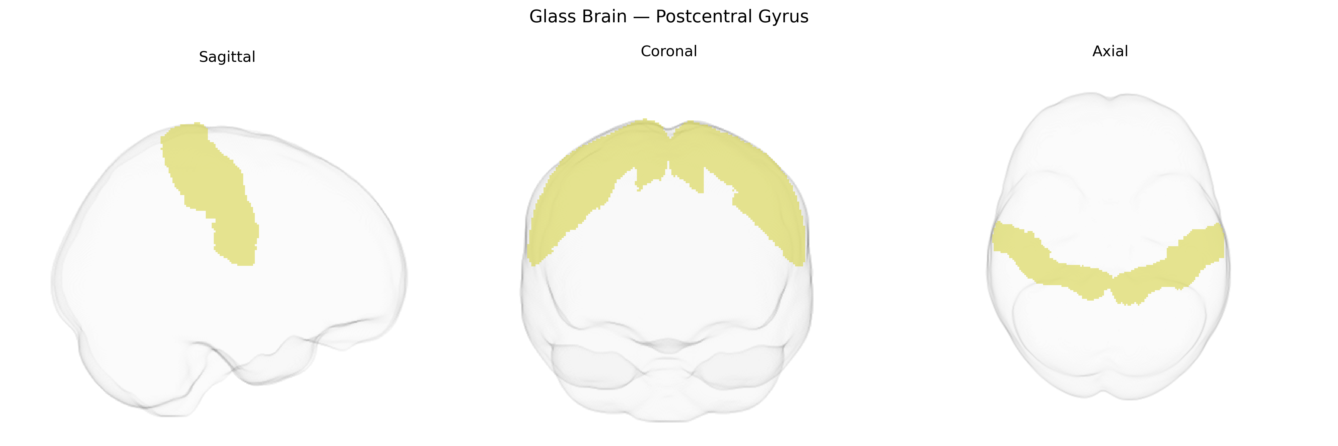 Triplanar Ghost Brain