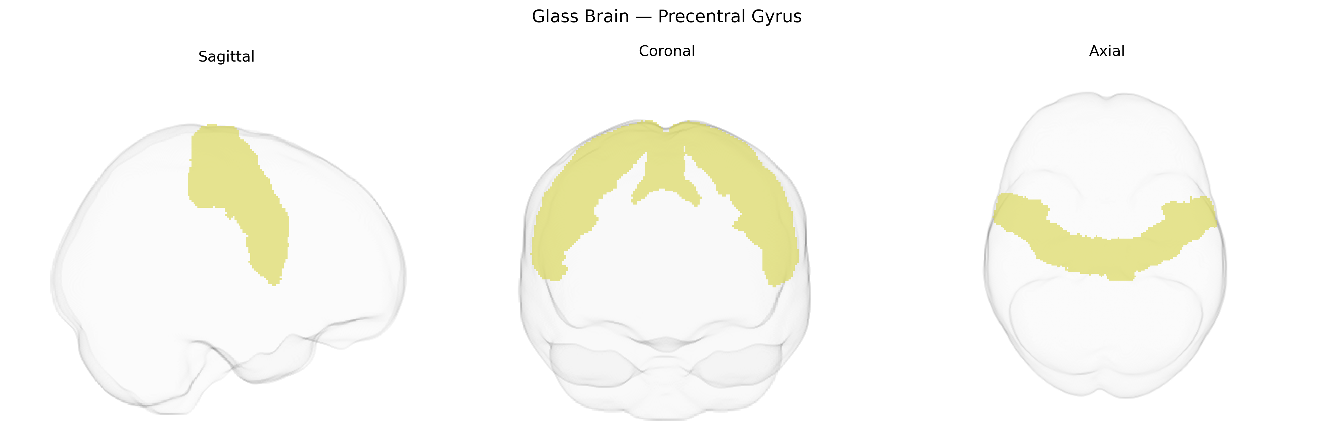 Triplanar Ghost Brain