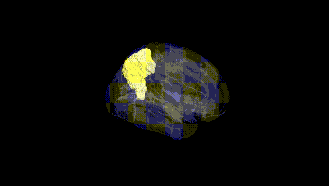 Full Brain Black