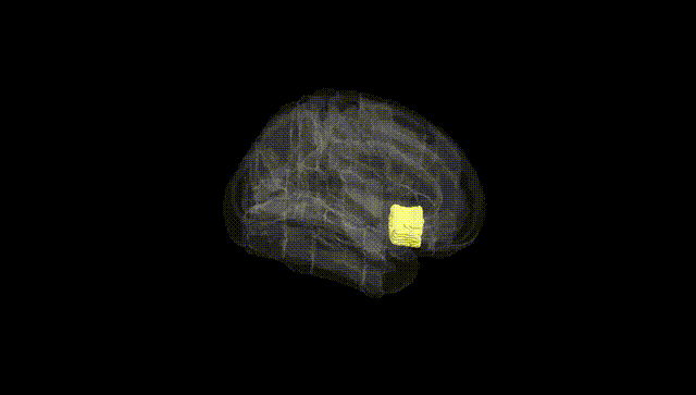 Full Brain Black