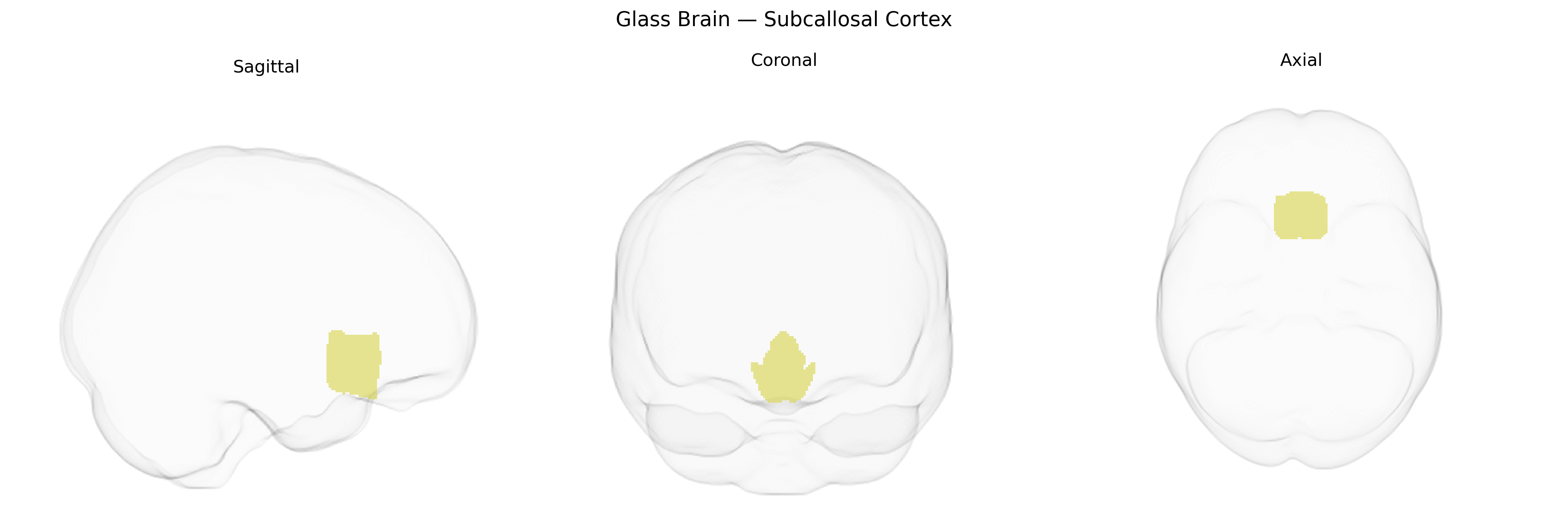Triplanar Ghost Brain