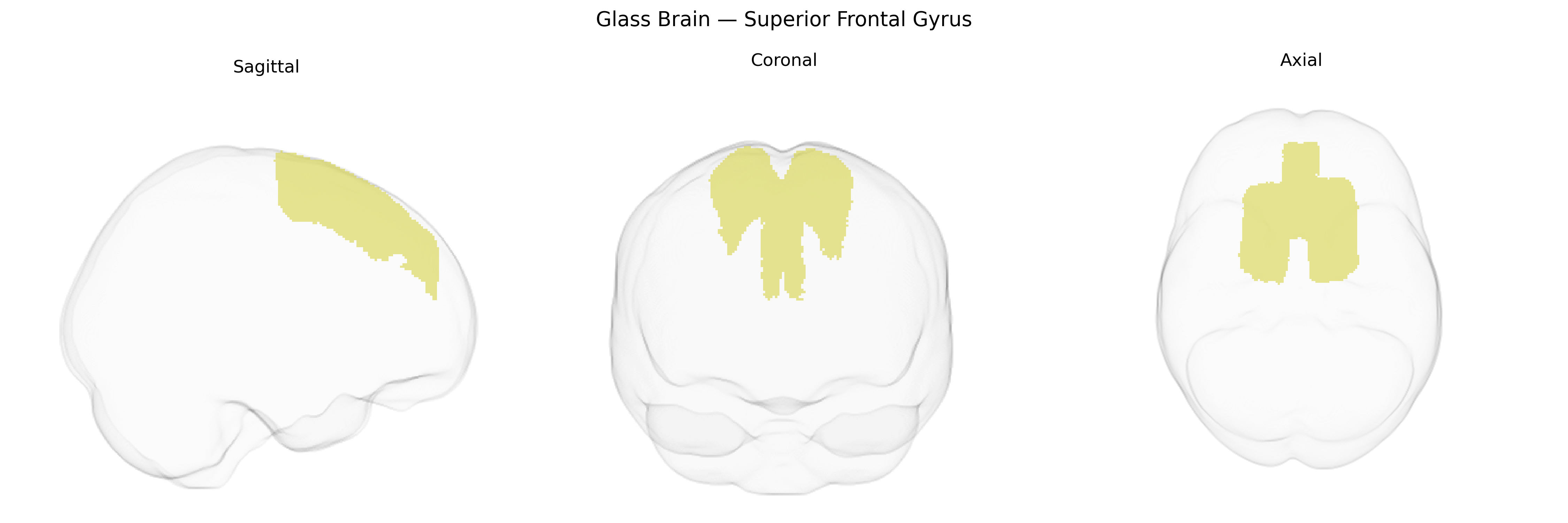 Triplanar Ghost Brain