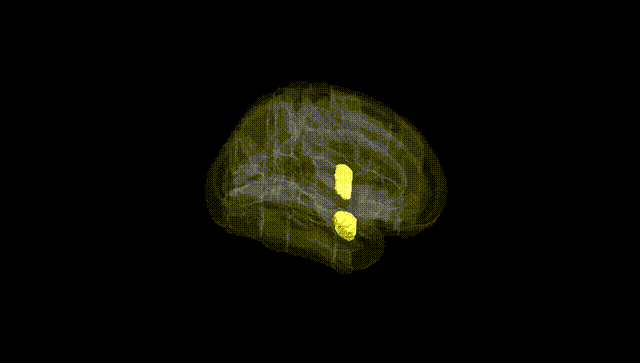 Full Brain Black
