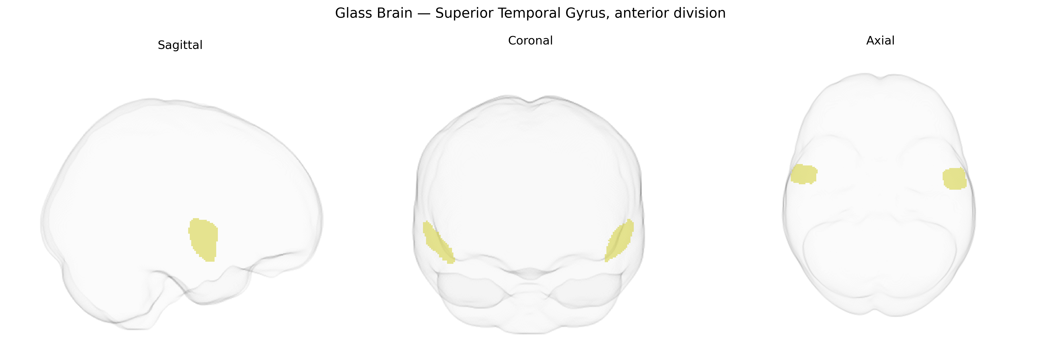 Triplanar Ghost Brain