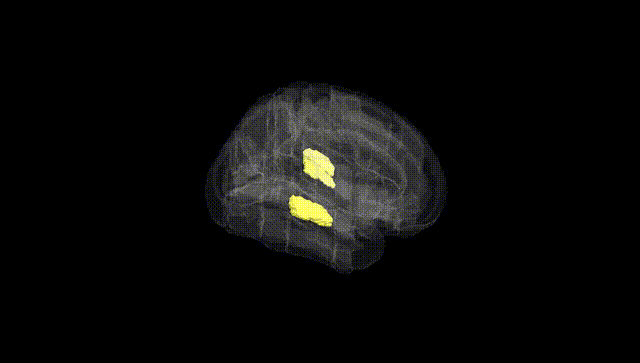 Full Brain Black