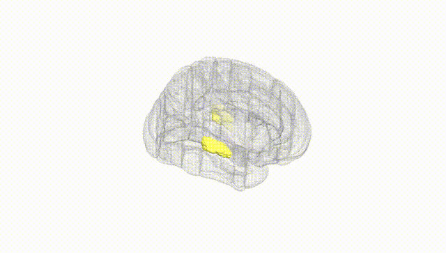 Full Brain White