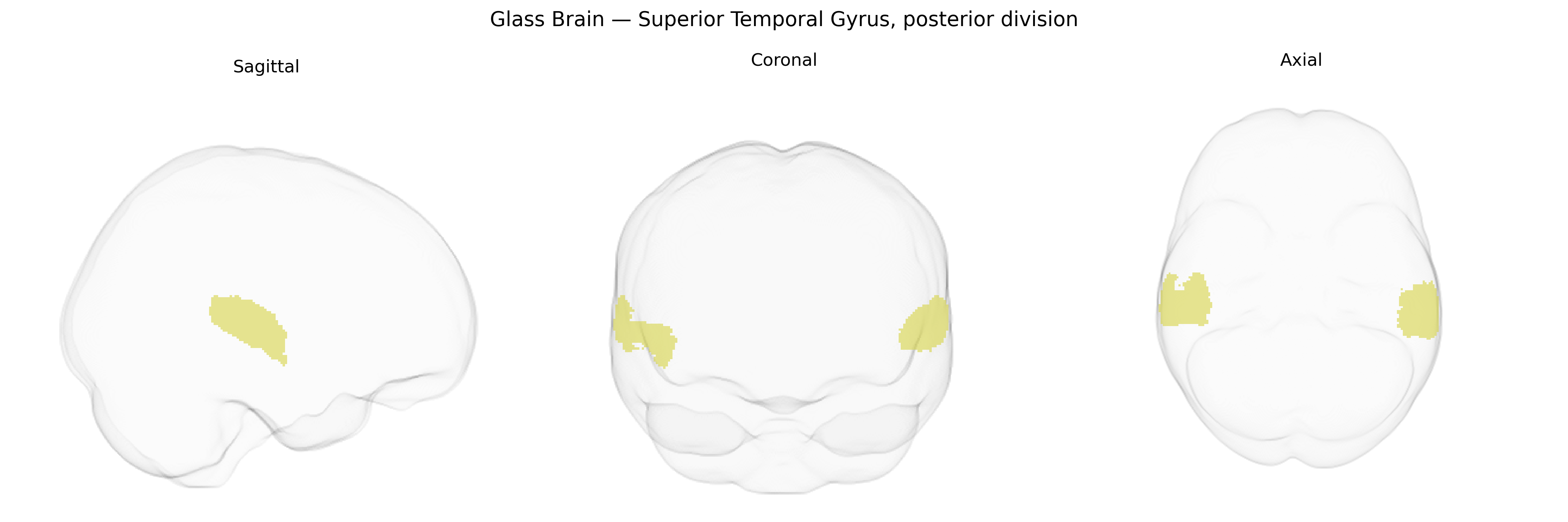 Triplanar Ghost Brain