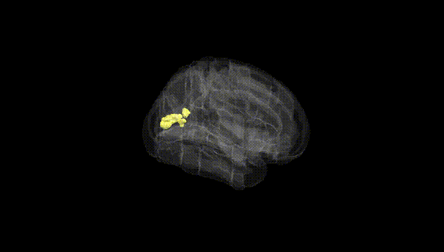 Full Brain Black