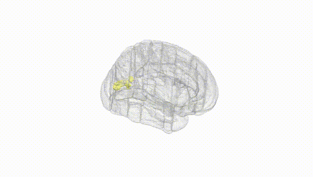 Full Brain White