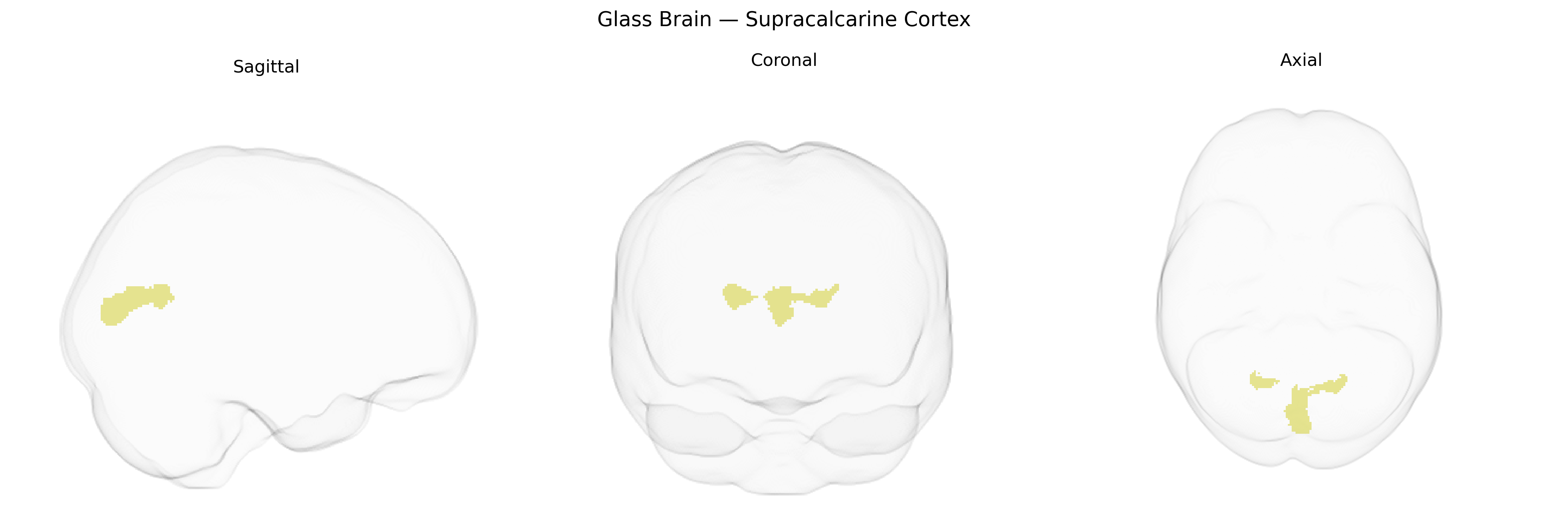 Triplanar Ghost Brain