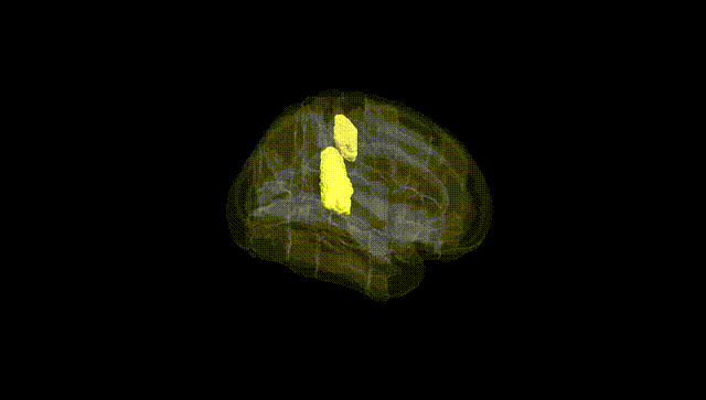 Full Brain Black