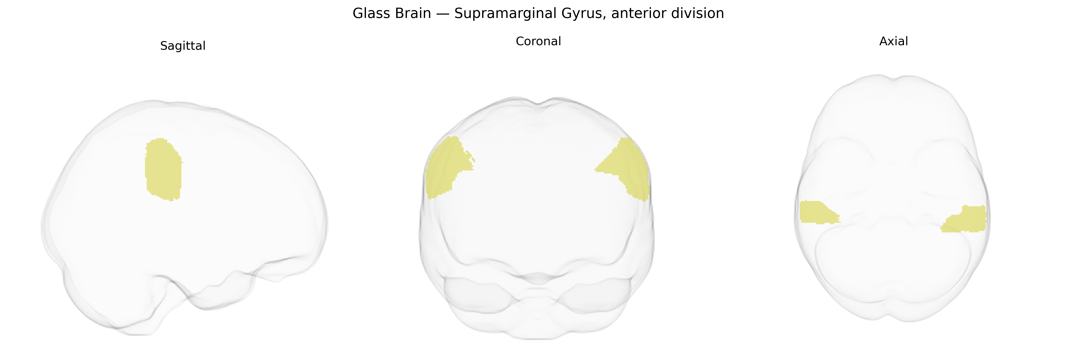 Triplanar Ghost Brain