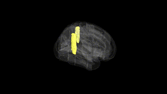 Full Brain Black