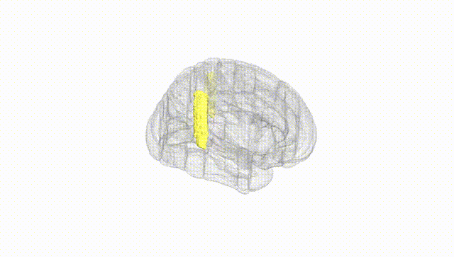 Full Brain White