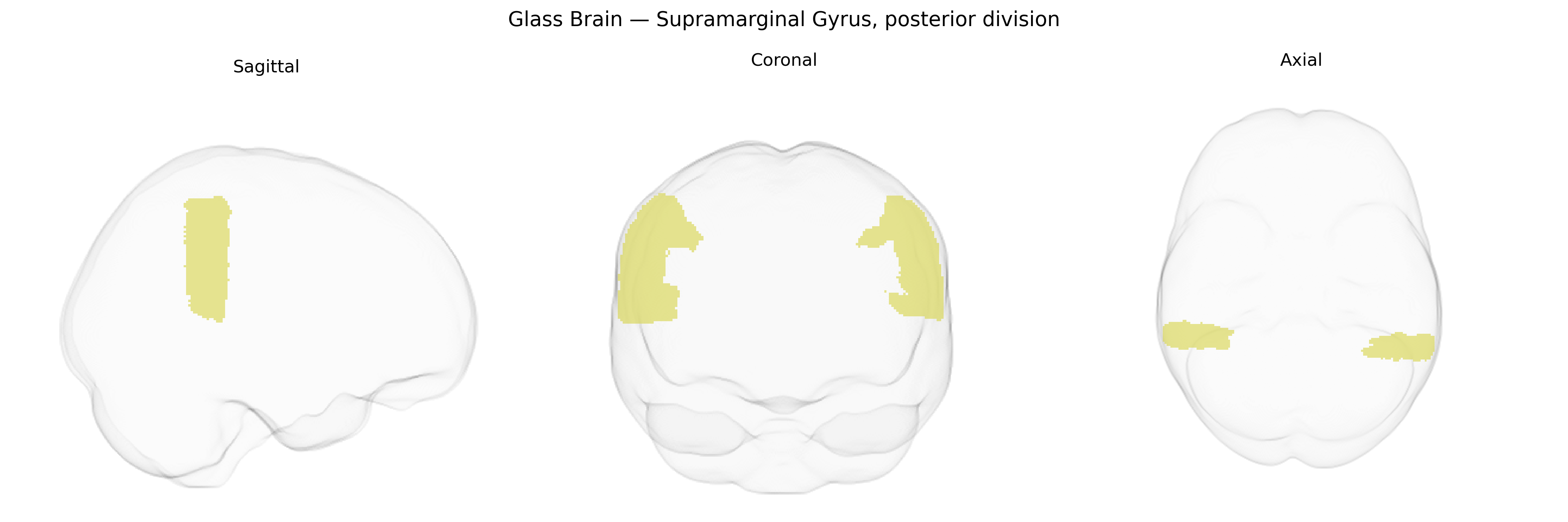 Triplanar Ghost Brain