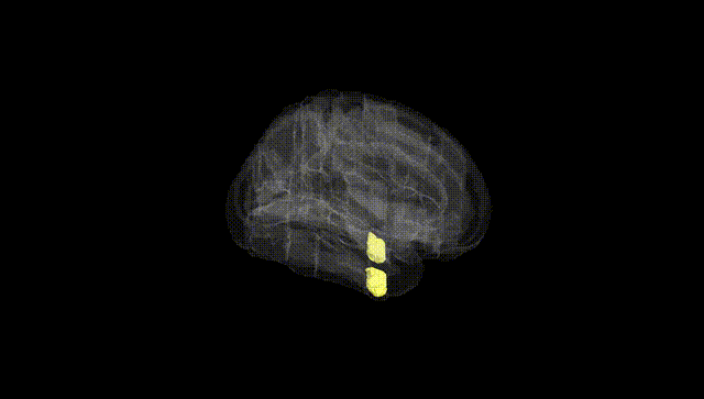 Full Brain Black