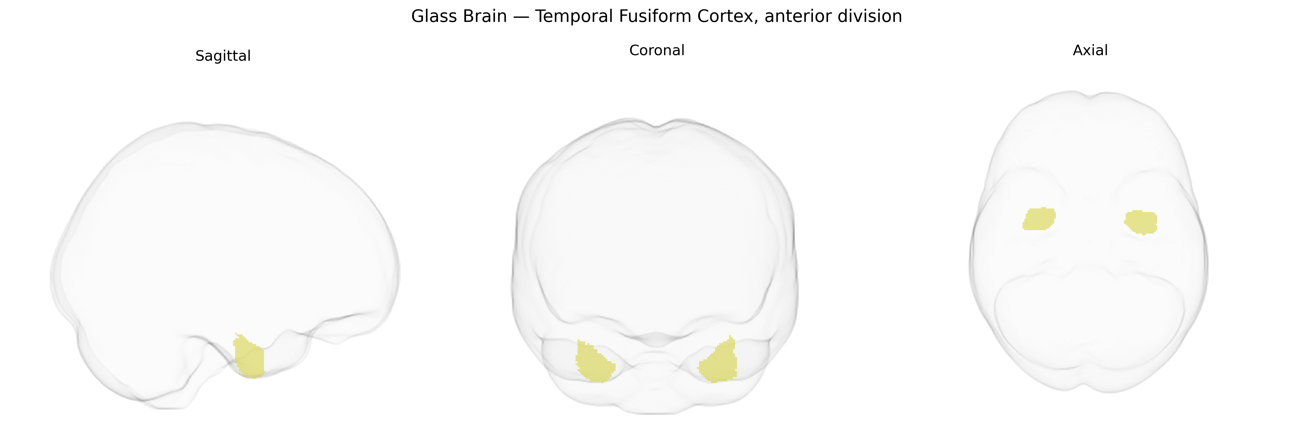 Triplanar Ghost Brain