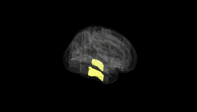 Full Brain Black