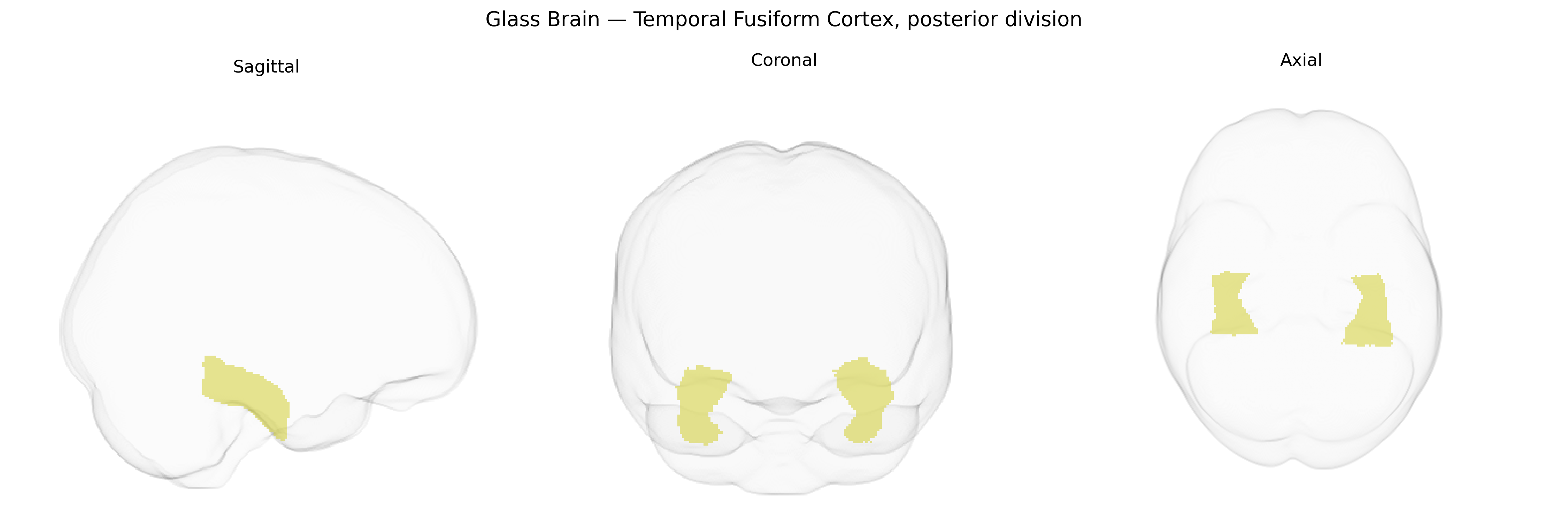Triplanar Ghost Brain