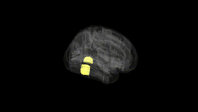 Full Brain Black