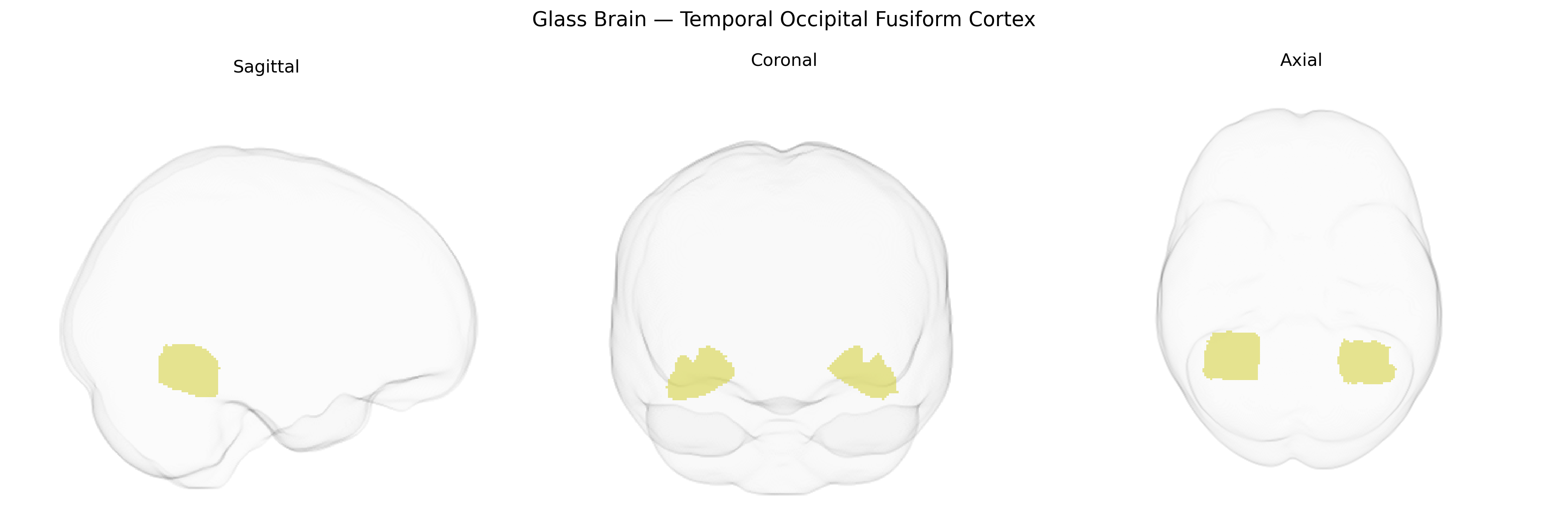 Triplanar Ghost Brain