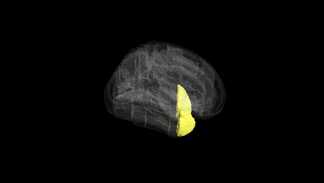 Full Brain Black