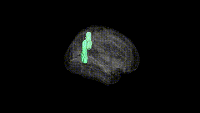 Full Brain Black