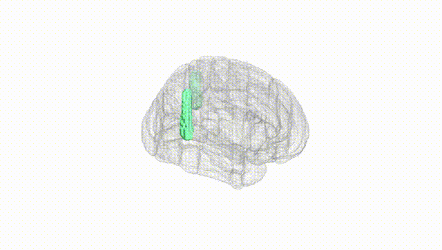 Full Brain White