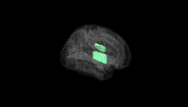 Full Brain Black
