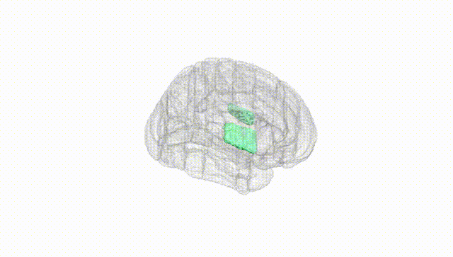 Full Brain White